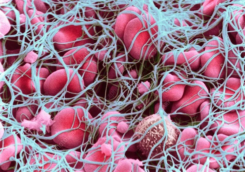 D-dimer (fibrinolytic activity)