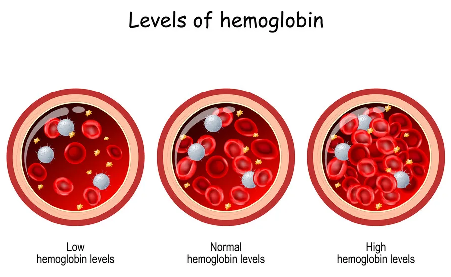 MCH – average hemoglobin content