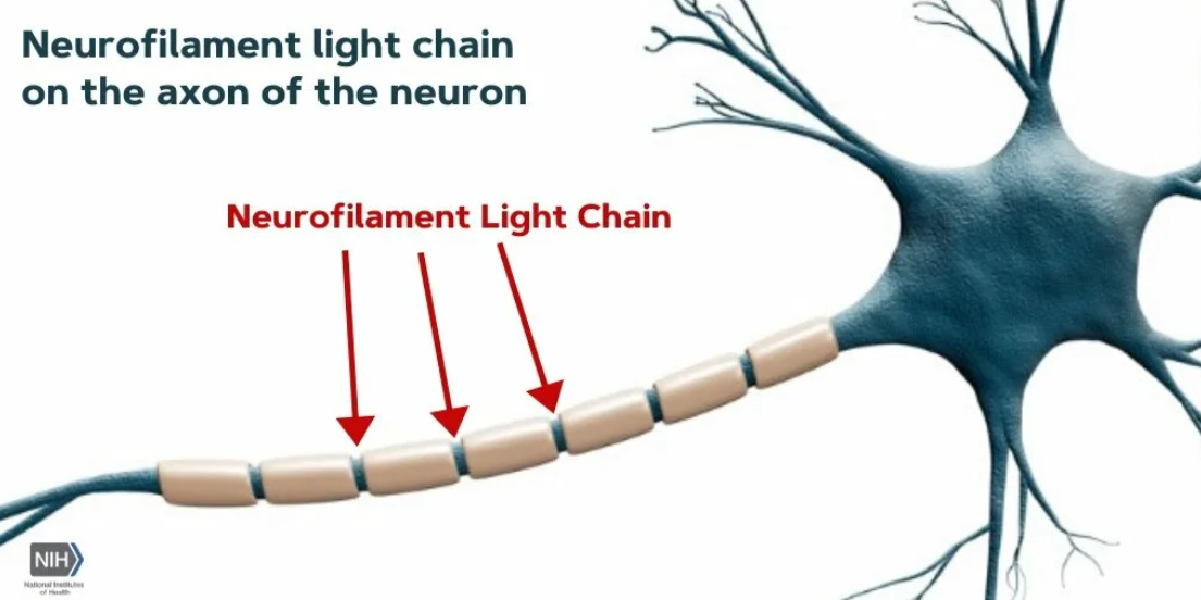 Light chain neurofilament