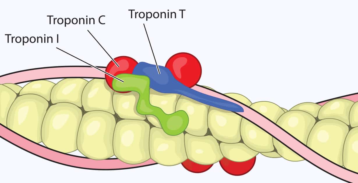 Troponin I